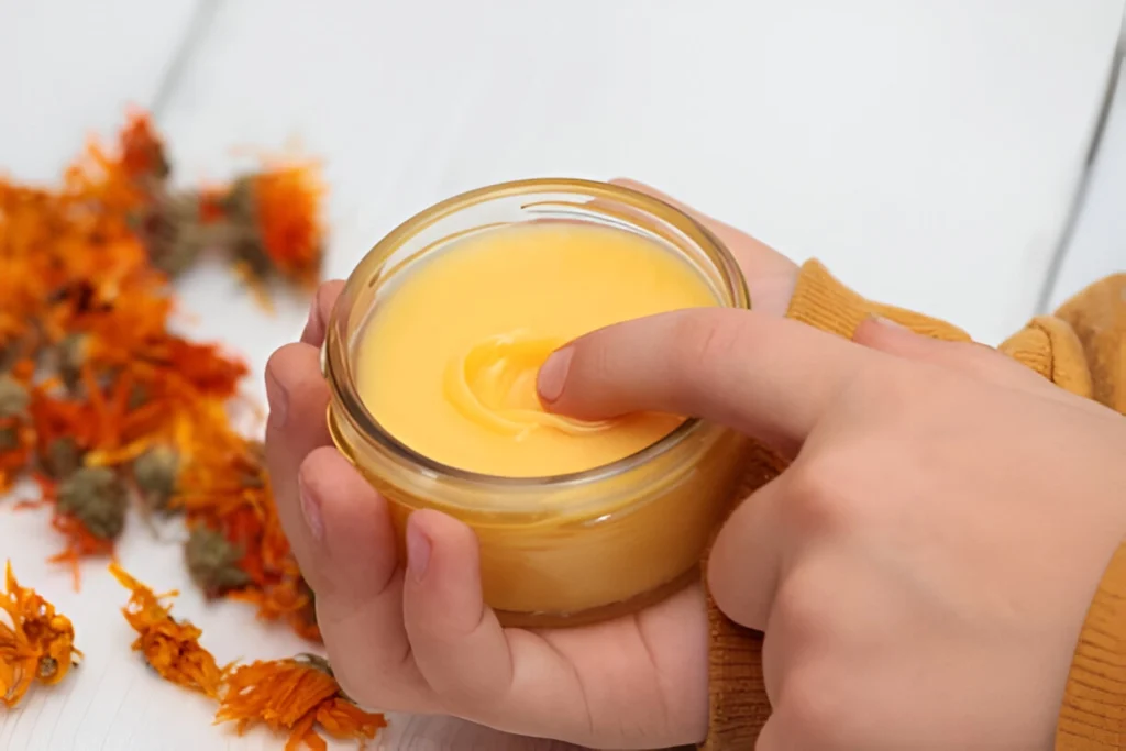 Calendula Cream- Best Baby Skin Care Tips